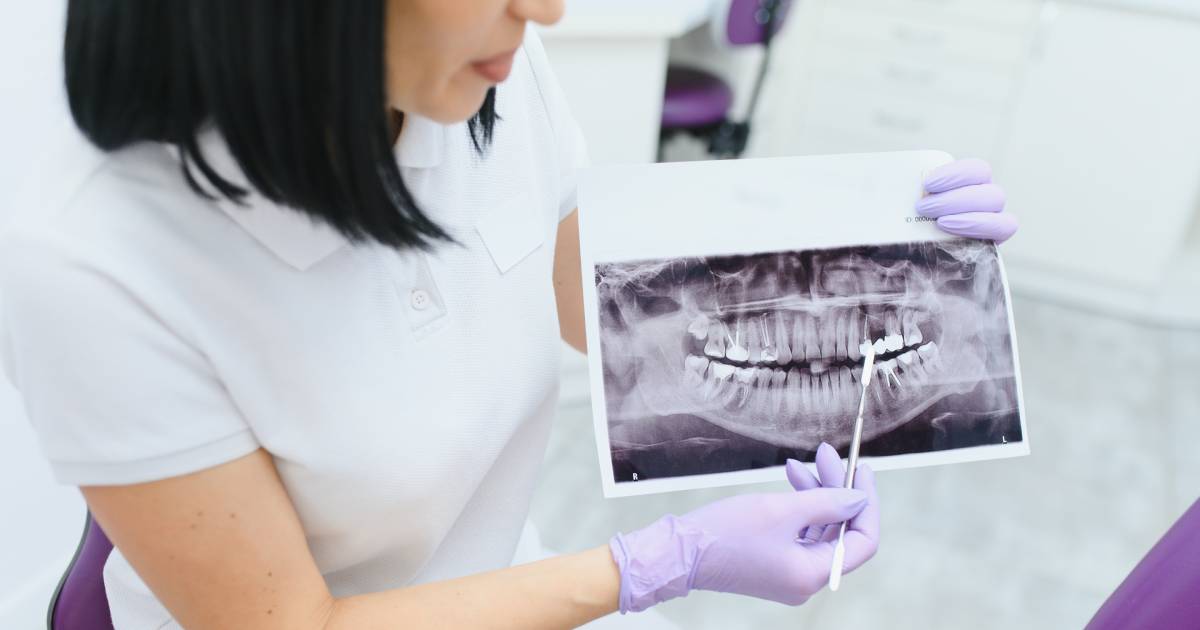 Dentist Explaining Scan