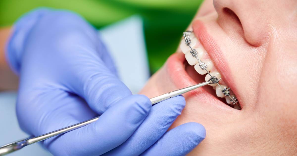 Orthodontist Checking Braces